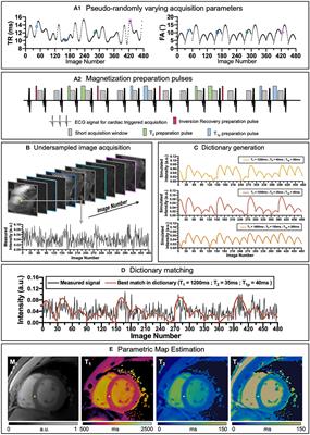 Artificial intelligence in cardiac magnetic resonance fingerprinting